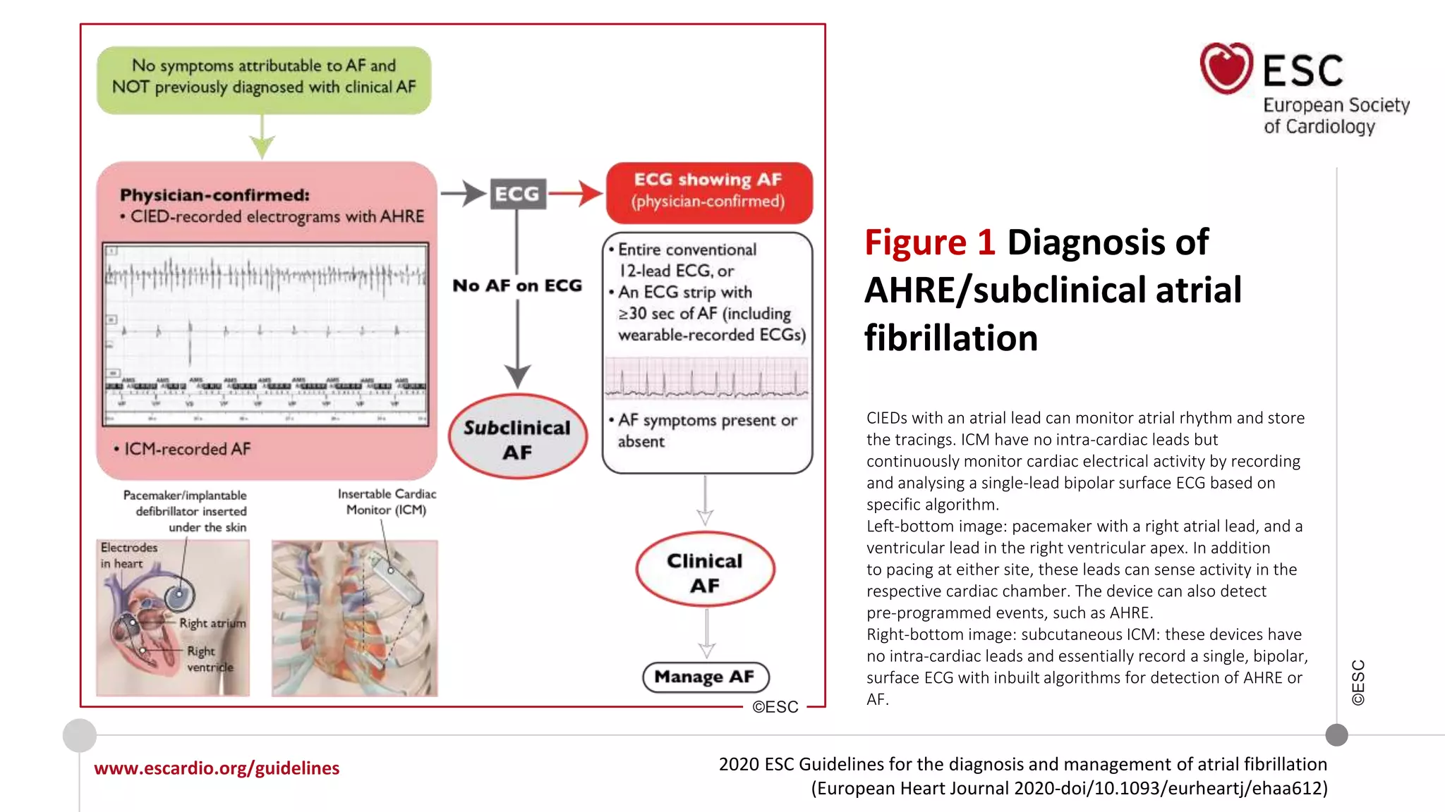 2020 ESC Guidelines for the diagnosis and management of atrial fibrillation
(European Heart Journal 2020-doi/10.1093/eurheartj/ehaa612)
www.escardio.org/guidelines
©ESC
Figure 1 Diagnosis of
AHRE/subclinical atrial
fibrillation
CIEDs with an atrial lead can monitor atrial rhythm and store
the tracings. ICM have no intra-cardiac leads but
continuously monitor cardiac electrical activity by recording
and analysing a single-lead bipolar surface ECG based on
specific algorithm.
Left-bottom image: pacemaker with a right atrial lead, and a
ventricular lead in the right ventricular apex. In addition
to pacing at either site, these leads can sense activity in the
respective cardiac chamber. The device can also detect
pre-programmed events, such as AHRE.
Right-bottom image: subcutaneous ICM: these devices have
no intra-cardiac leads and essentially record a single, bipolar,
surface ECG with inbuilt algorithms for detection of AHRE or
AF.©ESC
 