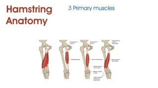 Hamstring
Anatomy
3 Primary muscles
 