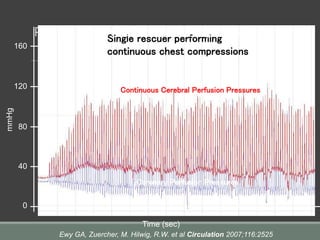 0
5 sec
80
160
mmHg
Time (sec)
40
120
Coronary Perfusion Pressures
Continuous Cerebral Perfusion Pressures
Single rescuer performing
continuous chest compressions
Ewy GA, Zuercher, M. Hilwig, R.W. et al Circulation 2007;116:2525
Perfusion with continuous compressions
 