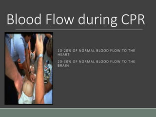 Blood Flow during CPR
10-20% OF NORMAL BLOOD FLOW TO THE
HEART
20-30% OF NORMAL BLOOD FLOW TO THE
BRAIN
 