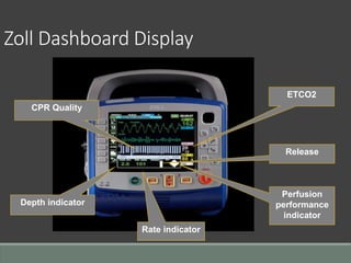 Zoll Dashboard Display
Rate indicator
Perfusion
performance
indicator
Depth indicator
Release
ETCO2
CPR Quality
 