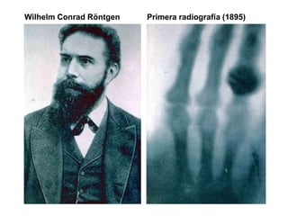 Wilhelm Conrad Röntgen Primera radiografía (1895)
 