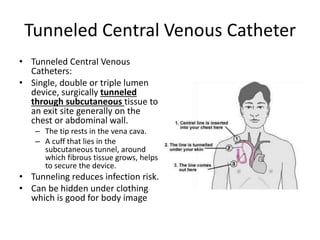 Tac Line 2020 parm 2223 u5 introduction to central venous access and Infusion ...