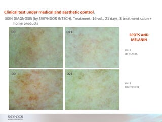 Clinical test under medical and aesthetic control.
SKIN DIAGNOSIS (by SKEYNDOR INTECH). Treatment: 16 vol., 21 days, 3 treatment salon +
home products
SPOTS AND
MELANIN
Vol. 5
LEFT CHEEK
Vol. 8
RIGHT CHEEK
D0 D21
D0 D21
 