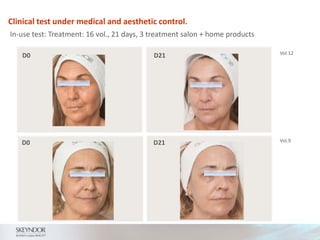 Clinical test under medical and aesthetic control.
In-use test: Treatment: 16 vol., 21 days, 3 treatment salon + home products
Vol.12
Vol.9
D0 D21
D0 D21
 