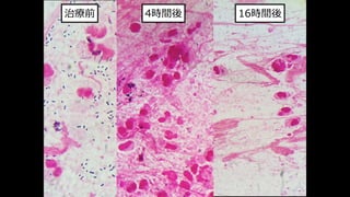 4時間後 16時間後
治療前
 