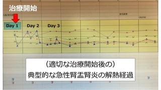 （適切な治療開始後の）
典型的な急性腎盂腎炎の解熱経過
治療開始
Day 1 Day 2 Day 3
 