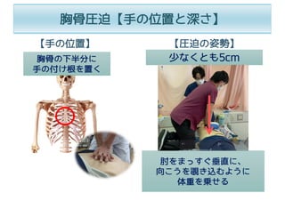 胸⾻圧迫【⼿の位置と深さ】
胸⾻の下半分に
⼿の付け根を置く
少なくとも5cm
肘をまっすぐ垂直に、
向こうを覗き込むように
体重を乗せる
【⼿の位置】 【圧迫の姿勢】
 