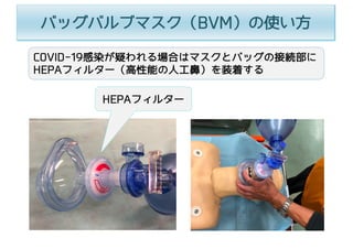 COVID-19感染が疑われる場合はマスクとバッグの接続部に
HEPAフィルター（⾼性能の⼈⼯⿐）を装着する
HEPAフィルター
バッグバルブマスク（BVM）の使い⽅
 