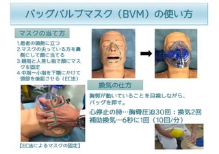 マスクの当て⽅
1.患者の頭側に⽴つ
2.マスクの尖っている⽅を⿐
側にして顔に当てる
3.親指と⼈差し指で顔にマス
クを固定
4.中指∼⼩指を下顎にかけて
頭部を後屈させる（EC法）
【EC法によるマスクの固定】
換気の仕⽅
胸郭が動いていることを⽬視しながら、
バッグを押す。
⼼停⽌の時…胸⾻圧迫30回：換気2回
補助換気…6秒に1回（10回/分）
バッグバルブマスク（BVM）の使い⽅
 