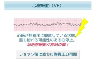 ⼼筋が無秩序に興奮している状態。
最も助かる可能性のある⼼停⽌。
早期除細動が救命の鍵！
⼼室細動（VF）
ショック後は直ちに胸⾻圧迫再開
 