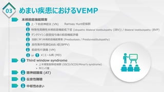 03 めまい疾患におけるVEMP
末梢前庭機能障害
上・下前庭神経炎 (VN)
特発性両側性末梢前庭機能低下症 (Idiopathic Bilateral Vestibulopathy (IBV)) / Bilateral Vestibulopathy (BVP)
Ramsay Hunt症候群
ゲンタマイシン鼓室投与後の前庭機能評価
良性発作性頭位めまい症(BPPV)
メニエール病 (MD)
or
聴神経腫瘍 (AT)
Third window syndrome
伝音性難聴
中枢性めまい
加齢に伴う末梢前庭機能障害 (Presbystasis / Presbyvestibulopathy)
 上半規管裂隙症候群 (SSCD/SCDS/Minor's syndrome)
 外リンパ瘻
前庭性片頭痛 (VM)
 