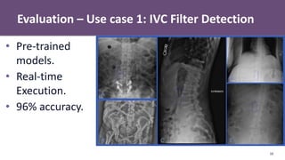 Evaluation – Use case 1: IVC Filter Detection
10
• Pre-trained
models.
• Real-time
Execution.
• 96% accuracy.
 