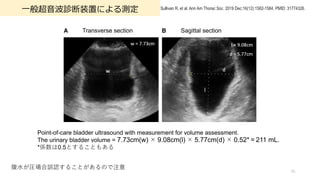 ?㳬?\װäˤy
91
Sullivan R, et al. Ann Am Thorac Soc. 2019 Dec;16(12):1582-1584. PMID: 31774326.
Point-of-care bladder ultrasound with measurement for volume assessment.
The urinary bladder volume = 7.73cm(w)??9.08cm(l)??5.77cm(d)??0.52*?=?211 mL.
*S0.5Ȥ뤳Ȥ⤢
?R`J뤳ȤΤע
Transverse section Sagittal section
 