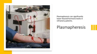 Plasmapheresis
Plasmapheresis can significantly
lower thyroid hormone levels in
refractory patients.
This Photo by Unknown Author is licensed under CC BY-SA
 