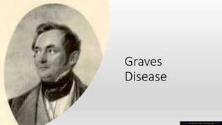 Graves
Disease
This Photo by Unknown Author is licensed under CC BY-SA
 