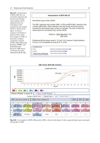 Abl Test Example 2021 BHARGAVA - Hematologic Malignancies .pdf