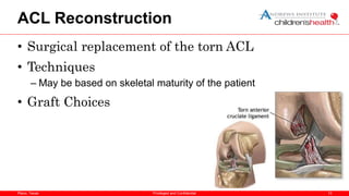 Plano, Texas
ACL Reconstruction
• Surgical replacement of the torn ACL
• Techniques
– May be based on skeletal maturity of the patient
• Graft Choices
13
Privileged and Confidential
 