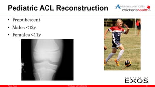 Plano, Texas
Pediatric ACL Reconstruction
• Prepubescent
• Males <12y
• Females <11y
18
Privileged and Confidential
 