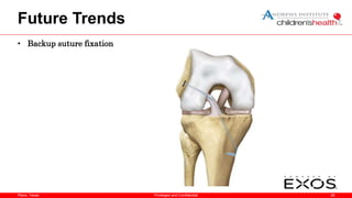 Plano, Texas
Future Trends
• Backup suture fixation
28
Privileged and Confidential
 