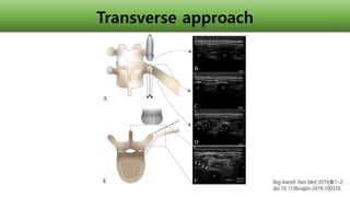 Transverse Line Approach 2021 KSCTVA Regional Anesthesia for Thoracic Surgery | PPTX