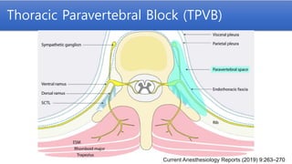 2021 KSCTVA Regional Anesthesia for Thoracic Surgery | PPTX