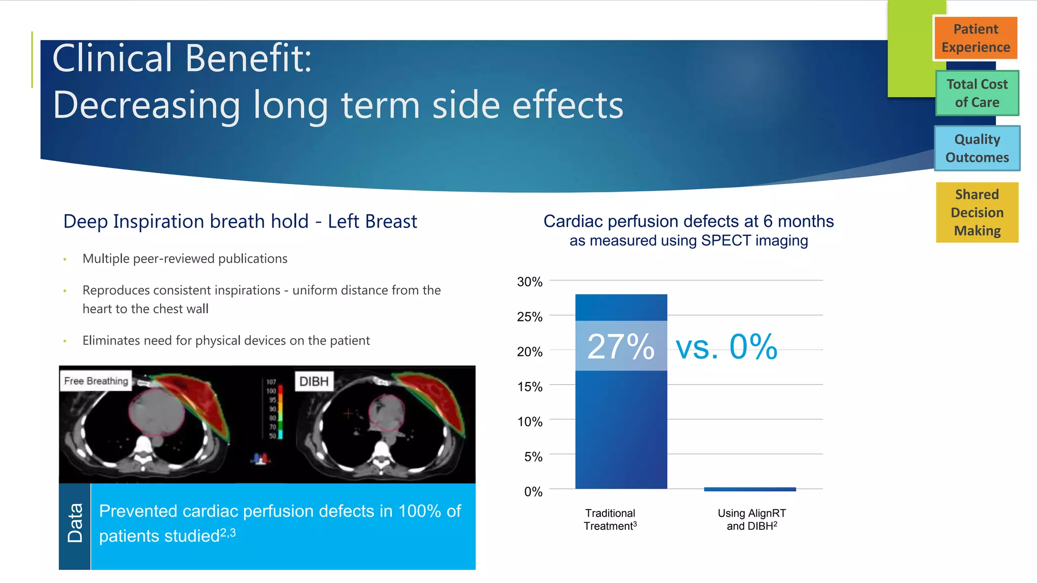 Clinical Benefit:
Decreasing long term side effects
Deep Inspiration breath hold - Left Breast
• Multiple peer-reviewed publications
• Reproduces consistent inspirations - uniform distance from the
heart to the chest wall
• Eliminates need for physical devices on the patient
Prevented cardiac perfusion defects in 100% of
patients studied2,3
Data
Cardiac perfusion defects at 6 months
as measured using SPECT imaging
30%
25%
20%
15%
10%
5%
0%
Traditional
Treatment3
Using AlignRT
and DIBH2
27% vs. 0%
Total Cost
of Care
Patient
Experience
Quality
Outcomes
Shared
Decision
Making
 
