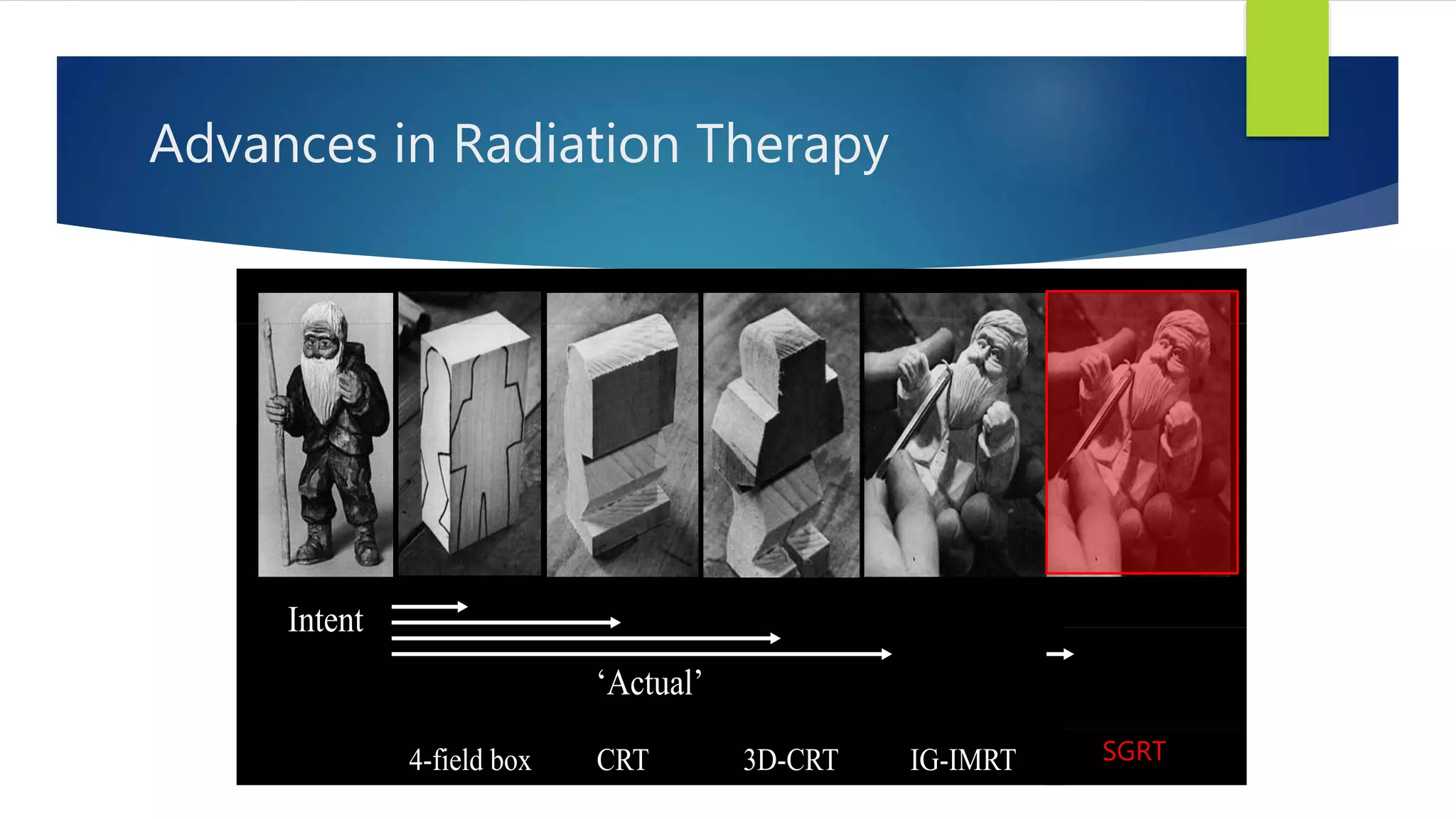 Advances in Radiation Therapy
Intent
Intent
‘Actual’
4-field box CRT 3D-CRT IG-IMRT
Intent
Intent
‘Actual’
4-field box CRT 3D-CRT IG-IMRT
SGRT
 