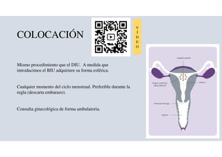 2022 09 14 BOLASINTRAUTERINAS ppt .pdf Descarga Gratuita