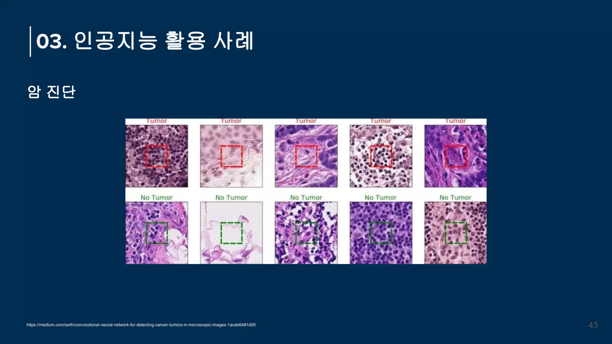 암 진단
03. 인공지능 활용 사례
43
https://medium.com/swlh/convolutional-neural-network-for-detecting-cancer-tumors-in-microscopic-images-1acab6481d05
 