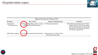 ICG guided robotic surgery
Wang X, Ann Surg 2021, 274: 97-106
 