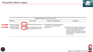ICG guided robotic surgery
Wang X, Ann Surg 2021, 274: 97-106
 