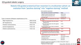 ICG guided robotic surgery
Chiow AKH, HPB 2021, 23: 475-482
Robotic ICG guided anatomical liver resection in a multicenter cohort: an
evolution from “positive staining” into “negative staining” method
 