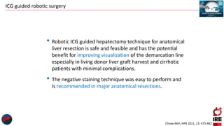 ICG guided robotic surgery
• Robotic ICG guided hepatectomy technique for anatomical
liver resection is safe and feasible and has the potential
benefit for improving visualization of the demarcation line
especially in living donor liver graft harvest and cirrhotic
patients with minimal complications.
• The negative staining technique was easy to perform and
is recommended in major anatomical resections.
Chiow AKH, HPB 2021, 23: 475-482
 