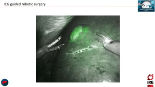 ICG guided robotic surgery
 