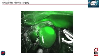 ICG guided robotic surgery
 