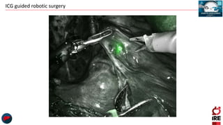 ICG guided robotic surgery
 