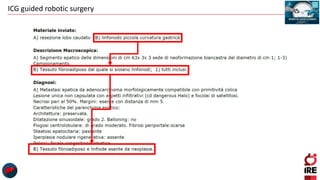 ICG guided robotic surgery
 