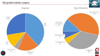 ICG guided robotic surgery
HCC
38%
Metastases
18%
Other Cancers
4%
CCA
12%
Benign
28%
Diagnosis
Left lateral
sectionectomy
12%
Minor resections
42%
1-2 Segments
34%
Left hepatectomy
5%
Right hepatectomy
7%
Type of Resection
 