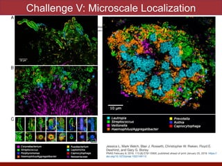 Challenge V: Microscale Localization
Jessica L. Mark Welch, Blair J. Rossetti, Christopher W. Rieken, Floyd E. Dewhirst, and Gary G. Borisy

PNAS February 9, 2016. 113 (6) E791-E800; published ahead of print January 25, 2016. https://doi.org/10.1073/pnas.1522149113
Jessica L. Mark Welch, Blair J. Rossetti, Christopher W. Rieken, Floyd E.
Dewhirst, and Gary G. Borisy

PNAS February 9, 2016. 113 (6) E791-E800; published ahead of print January 25, 2016. https://
doi.org/10.1073/pnas.1522149113
 