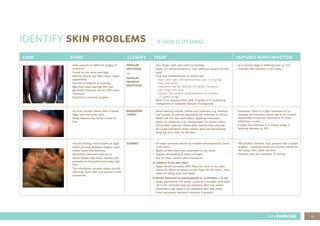 61
SKIN PROBLEMS
IDENTIFY SKIN PROBLEMS
LOOK SIGNS CLASSIFY TREAT FEATURES IN HIV INFECTION
• Itchy papules at different stages of
evolution.
• Found on the arms and legs.
• Healed lesions are often dark/ hyper
pigmented.
• The itch is difficult to manage.
• May flare after starting ART, but
generally improves as the CD4 count
increases.
• Essential to exclude scabies.
PAPULAR
URTICARIA
OR
PAPULAR
PRURITIC
ERUPTIONS
• Trim finger nails and avoid scratching.
• Apply 1% hydrocortisone to new, inflamed lesions for five
days.
• Give oral antihistamine to relieve itch:
- Short term use: Chlorphenamine, oral, 0.1mg/kg/
dose 6-8 hourly
- Long term use for children 2-6 years: Cetirizine,
oral, 5mg once daily
- Caution: Do not give antihistamines to children
< 2 years of age.
• Refer if no improvement after 2 weeks or if underlying
malignancy or systemic disease is suspected.
• Is a clinical stage 2 defining case (p. 53)
• Consider HIV infection in all cases.
• An itchy circular lesion with a raised
edge and fine scaly area.
• Scalp lesions may result in loss of
hair.
RINGWORM
(TINEA)
• Avoid sharing clothes, towels and toiletries (e.g. brushes
and combs) to prevent spreading the infection to others.
• Wash and dry skin well before applying treatment.
• Apply an imidazole (e.g. clotrimazole 1% cream) three
times daily until two weeks after lesions have cleared.
• For scalp infections (tinea capitis) give oral fluconazole
6mg/kg once daily for 28 days.
• Extensive: there is a high incidence of co-
existing nail infection which has to be treated
adequately to prevent recurrence of tinea
infections of skin.
• Fungal nail infection is a clinical stage 2
defining disease (p. 53).
• Intense itching, more severe at night.
• Small burrows between fingers, tows,
elbow areas and buttocks.
• Secondary infection may occur.
• Small babies may have vesicles and
pustules on the palms and soles and
face.
• The infestation spreads easily, usually
affecting more than one person in the
household.
SCABIES • All close contacts should be treated simultaneously (even
if not itchy).
• Wash all bed linen and underwear in hot water
• Expose all bedding to direct sunlight.
• Put on clean clothes after treatment.
In children 6 yrs and older
• Apply benzyl benzoate 25% from the neck to the toes.
Allow the lotion to remain on the body for 24 hours , then
wash off using soap and water.
If benzyl benzoate is unsuccessful or in children > 6 yrs
• Apply permethrin 5% lotion. Leave on overnight and wash
off in the morning (may be repeated after one week).
• Treatment may need to be repeated after one week.
• Treat secondary bacterial infection if present.
• HIV-positive children, may present with crusted
scabies - extensive areas of crusting mainly on
the scalp, face, back and feet.
• Patients may not complain of itching.
IF SKIN IS ITCHING
 