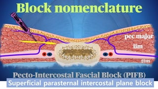 Interpectoral Block 2022 KSCTVA Sono-guided nerve blocks for cardio-thoracic surgery.pptx