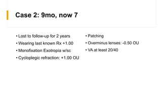 Case 2: 9mo, now 7
• Lost to follow-up for 2 years
• Wearing last known Rx +1.00
• Monofixation Exotropia w/sc
• Cycloplegic refraction: +1.00 OU
• Patching
• Overminus lenses: -0.50 OU
• VA at least 20/40
 