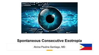 Spontaneous Consecutive Exotropia
Alvina Pauline Santiago, MD
 