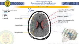 A VIEWPOINT AND MANAGEMENT ON
CEREBROVASCULAR & RELATED DISORDERS
FOR ALLIED HEALTH WORKERS AND PRACTITIONERS
Basics of Cranial CT
Worms
Frontal lobe
Parietal lobe
Occipital lobe
Caudate Nucleus
Lateral Ventricles with CSF
(Occipital Horn)
Lateral Ventricles with CSF
(Frontal Horn)
Remember these guide terms
1. Coffee Bean
2. Worms
3. Angry
4. Happy
5. Star
6. X-factor
֍ Lindsay, K.W., Bone, I., & Geraint, F. (2011). Neurology and neurosurgery illustrated - 5th Edition. 2011 Elsevier Ltd. ISBN 978-0-443-06957-4
 