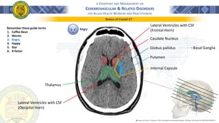 A VIEWPOINT AND MANAGEMENT ON
CEREBROVASCULAR & RELATED DISORDERS
FOR ALLIED HEALTH WORKERS AND PRACTITIONERS
Basics of Cranial CT
Remember these guide terms
1. Coffee Bean
2. Worms
3. Angry
4. Happy
5. Star
6. X-factor
Angry
Lateral Ventricles with CSF
(Frontal Horn)
Caudate Nucleus
Internal Capsule
Globus pallidus
Putamen
Thalamus
Basal Ganglia
Lateral Ventricles with CSF
(Occipital Horn)
֍ Lindsay, K.W., Bone, I., & Geraint, F. (2011). Neurology and neurosurgery illustrated - 5th Edition. 2011 Elsevier Ltd. ISBN 978-0-443-06957-4
 