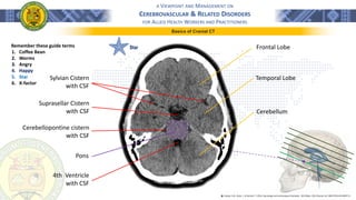 A VIEWPOINT AND MANAGEMENT ON
CEREBROVASCULAR & RELATED DISORDERS
FOR ALLIED HEALTH WORKERS AND PRACTITIONERS
Basics of Cranial CT
Remember these guide terms
1. Coffee Bean
2. Worms
3. Angry
4. Happy
5. Star
6. X-factor
Suprasellar Cistern
with CSF
Sylvian Cistern
with CSF
4th Ventricle
with CSF
Star Frontal Lobe
Temporal Lobe
Cerebellum
Pons
Cerebellopontine cistern
with CSF
֍ Lindsay, K.W., Bone, I., & Geraint, F. (2011). Neurology and neurosurgery illustrated - 5th Edition. 2011 Elsevier Ltd. ISBN 978-0-443-06957-4
 