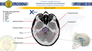 A VIEWPOINT AND MANAGEMENT ON
CEREBROVASCULAR & RELATED DISORDERS
FOR ALLIED HEALTH WORKERS AND PRACTITIONERS
Basics of Cranial CT
Remember these guide terms
1. Coffee Bean
2. Worms
3. Angry
4. Happy
5. Star
6. X-factor
Xfactor
Sphenoid Bone
Temporal Bone
Temporal Lobe
Cerebellum
4th Ventricle
Pons
Occipital Bone
 