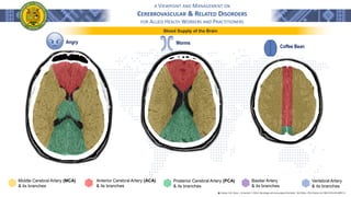 A VIEWPOINT AND MANAGEMENT ON
CEREBROVASCULAR & RELATED DISORDERS
FOR ALLIED HEALTH WORKERS AND PRACTITIONERS
Blood Supply of the Brain
֍ Lindsay, K.W., Bone, I., & Geraint, F. (2011). Neurology and neurosurgery illustrated - 5th Edition. 2011 Elsevier Ltd. ISBN 978-0-443-06957-4
Coffee Bean
Worms
Angry
Middle Cerebral Artery (MCA)
& its branches
Anterior Cerebral Artery (ACA)
& its branches
Posterior Cerebral Artery (PCA)
& its branches
Basilar Artery
& its branches
Vertebral Artery
& its branches
 
