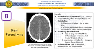 A VIEWPOINT AND MANAGEMENT ON
CEREBROVASCULAR & RELATED DISORDERS
FOR ALLIED HEALTH WORKERS AND PRACTITIONERS
ABCs for Cranial Scan: The Basic Approach
B
Brain
Parenchyma
Look for
• Brain Midline Displacement: (Falx Cerebri) –
Cerebral Edema / Mass Effect on affected side.
• Brain Sulcus
A. Effacement of Sulcus – due to Mass
Effect
B. Widened and Shallow Sulcus – Increased
CSF (in case of hydrocephalus) or Atrophy
• Brain Gray-White Junction
A. Loss of Gray and White Matter
Differentiation – Infarction (Cell
Death/ Cytotoxic Edema)
B. Accentuation of the Border – Vasogenic
Edema (Tumor/Abscess)
• Brain Densities: Look for abnormal
Hyperdensities and Hypodensities
No Midline Displacement, Normal Sulcal
Effacement, Normal Gray-White Border, No
any other hypo/hyperdensities
 